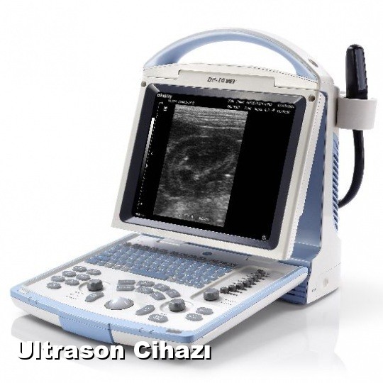 Ultrason Cihazı