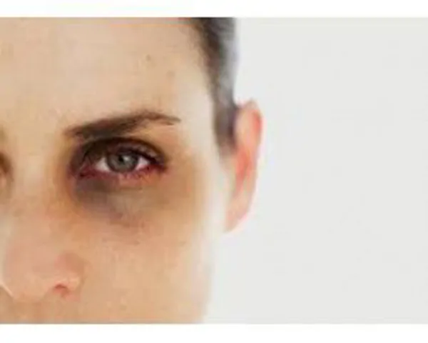 Creams/serums for dark circles and bags under the eyes