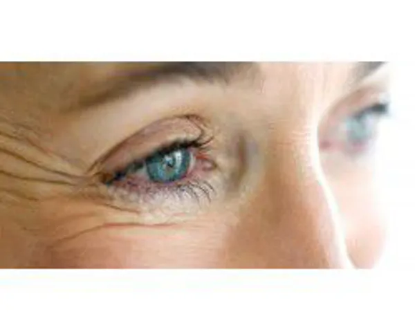 Eye area wrinkle (crow's feet) cream/serum