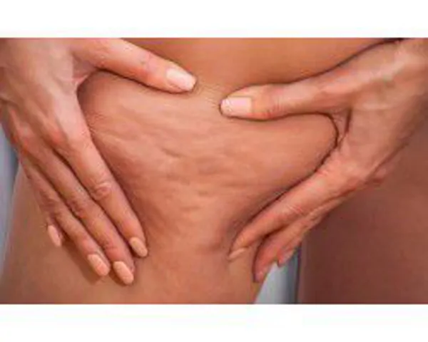 Cellulite cream/serum