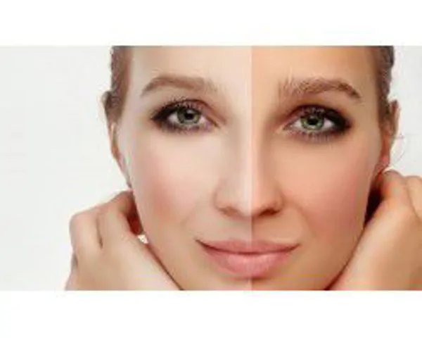 Whitening Creams