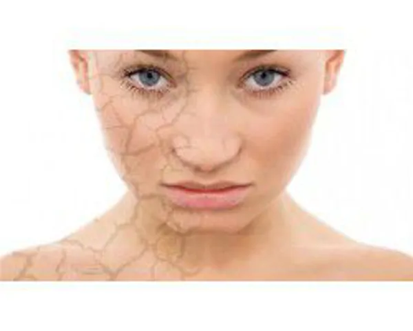 Intensive moisturizing cream for sensitive skin.